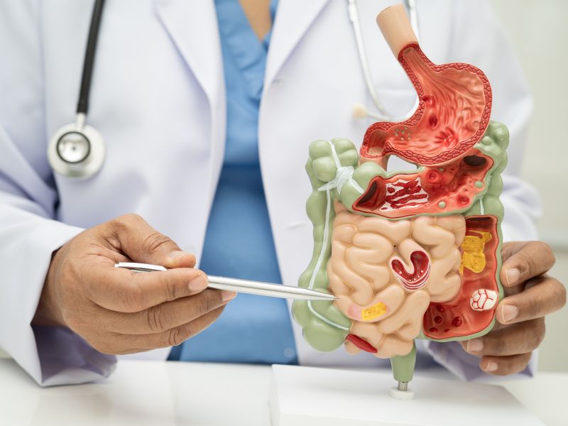 Disbiose intestinal: sintomas, causas e como tratar o desequilíbrio no intestino