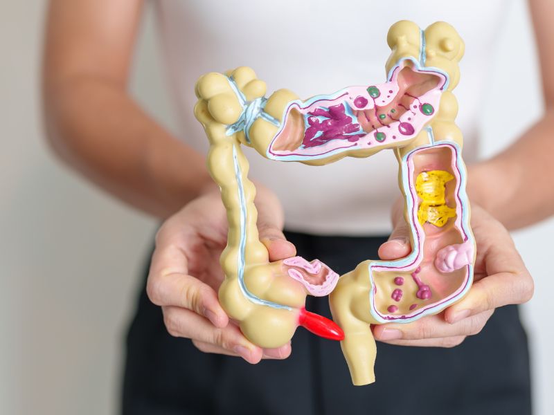 Modulação intestinal